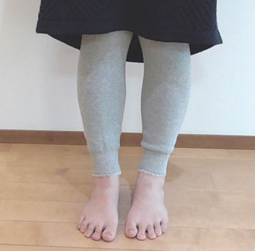 小ロット サントウニット 風景